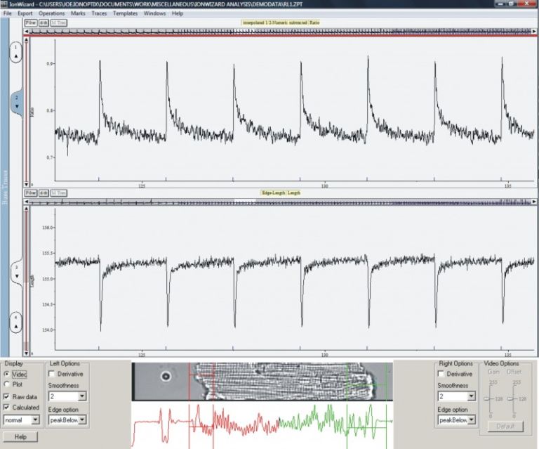 Real Time Acquisition of Cell Length