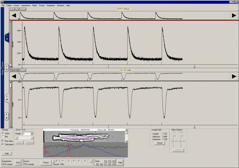 Real Time Acquisition of Sarcomere Length