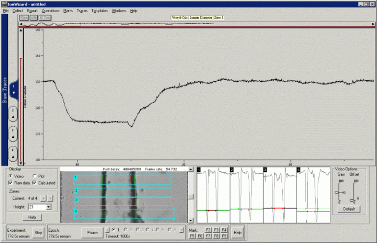 VesAcq Interface