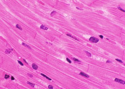 Muscle Tissue Solutions - IonOptix