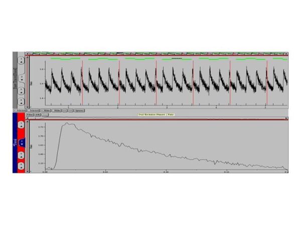 Iologic Pulse Cardiac Myocytes - IonOptix