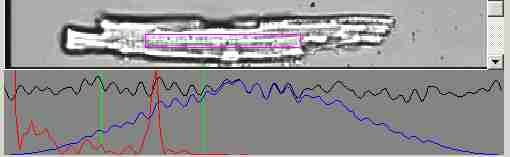 SarcLen Image and Intensity Windows